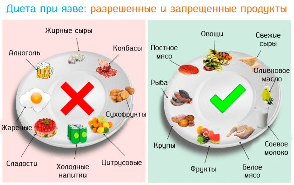 Какой сыр можно есть при диабете. Диетотерапия при язвенной болезни желудка. При обострении язвенной болезни желудка необходимо питаться. Диета приязаеной болезни. Диета прия зые желудка.